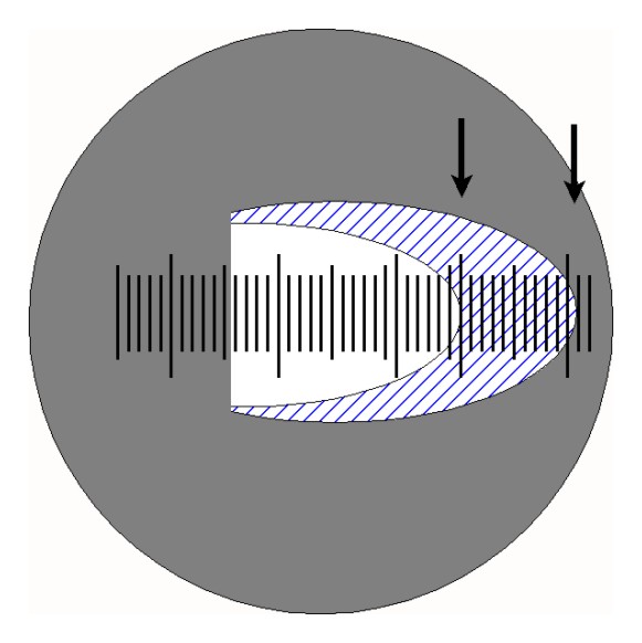 Drawing of the incision